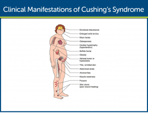 Clinical Manifestations of Cushing's Syndrome