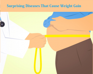 Surprising Diseases That Cause Weight Gain for health