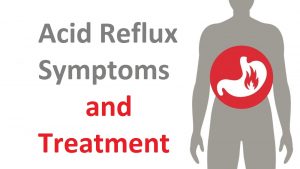 Acid Reflux symptoms and treatment