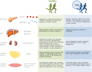 Avoid Exercise If Your Blood Glucose Level is High