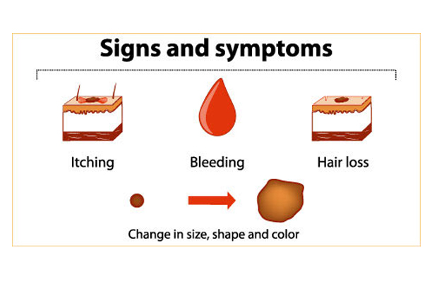 Cancer symptoms and signs