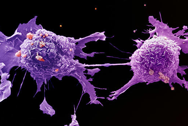 cancer develop