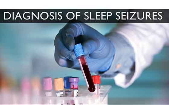 Can You Have A Seizure In Your Sleep - Fitness Health Forever